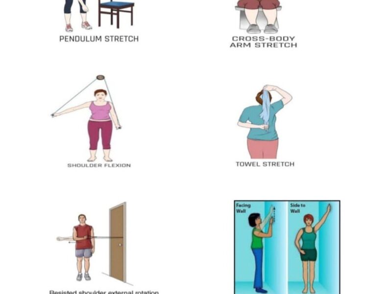 Frozen Shoulder Physiotherapy