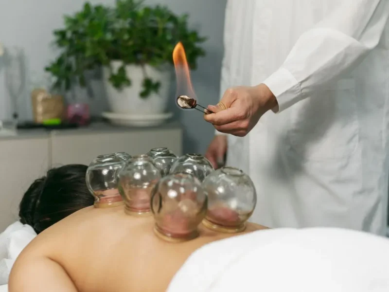 Cupping Therapy For Lower Back Pain: Benefits, Process, and Expert Guide