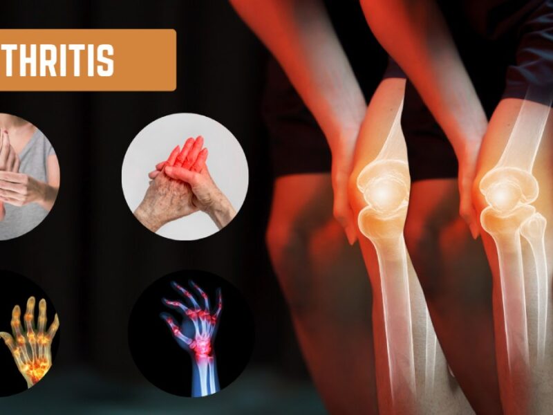 What is The Best Exercise for Arthritis in Fingers, Hands and Legs?