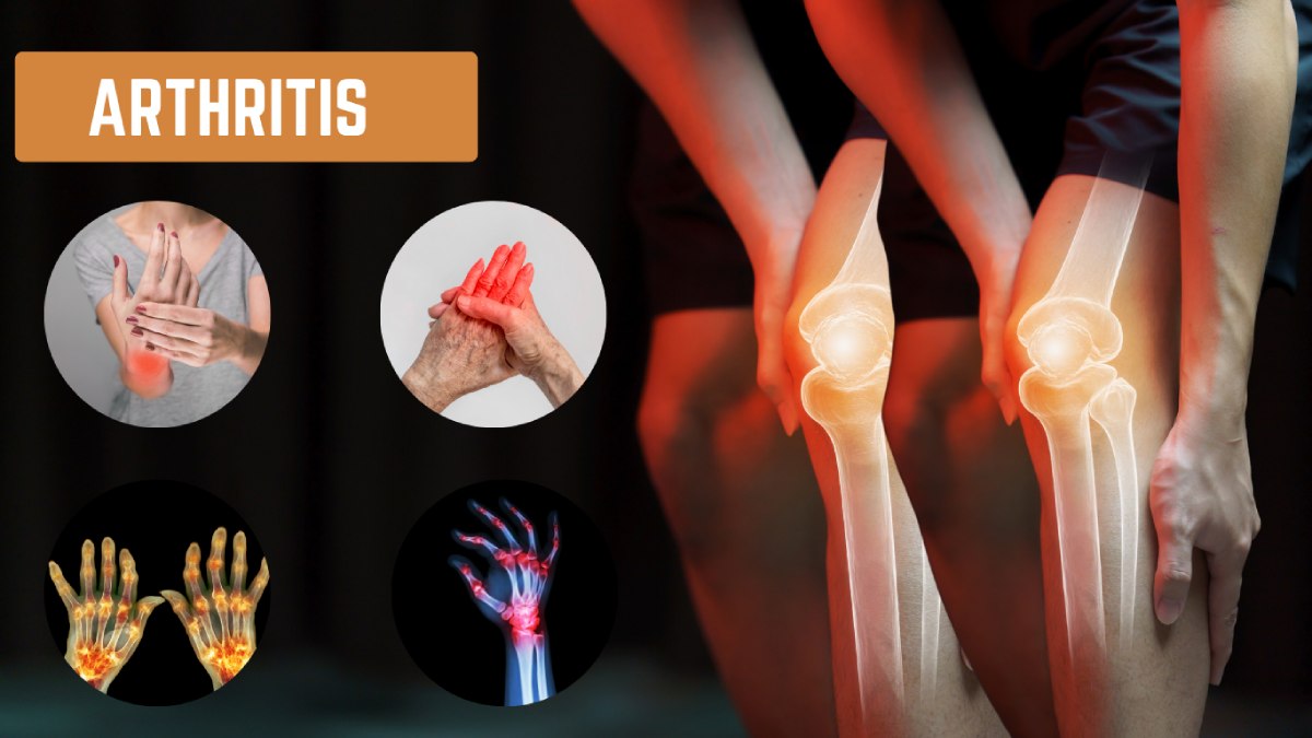 exercise for arthritis in Kolkata